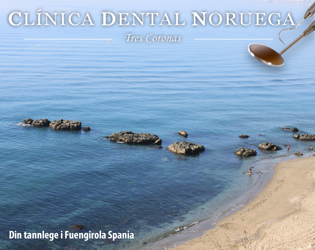 Tannlege-Fuengirola-Spania-Clinica-Dental-Noruega